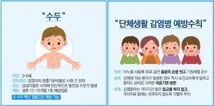 안산시, 수두 환자 증가에 따른 주의 당부…“예방수칙 지키세요”